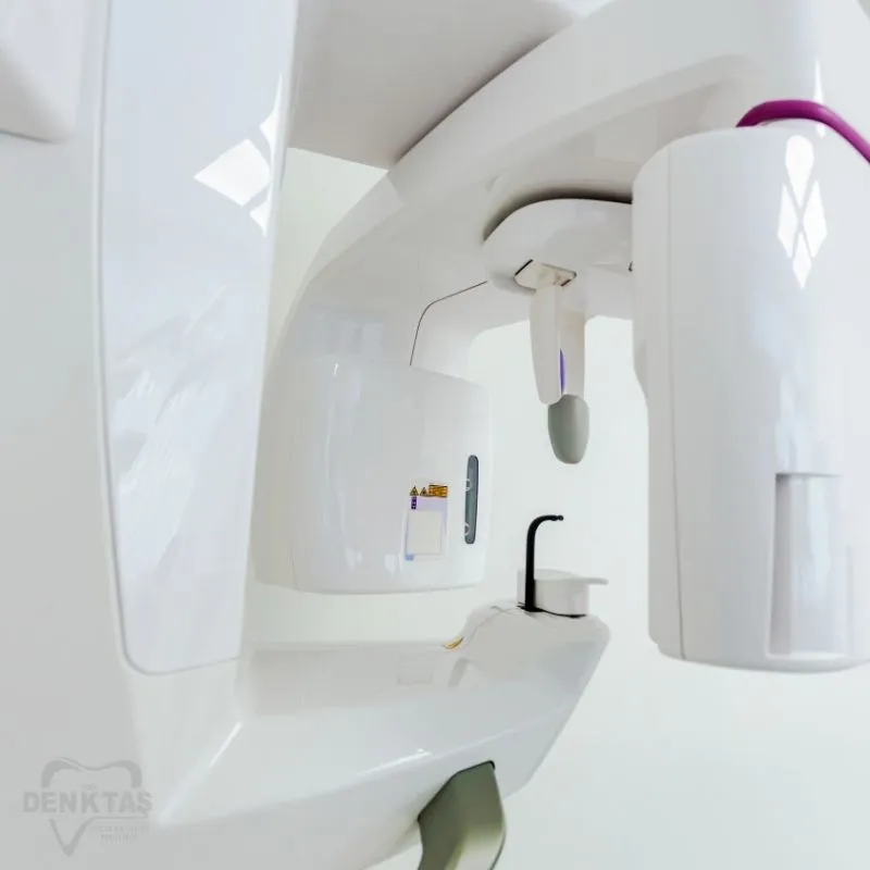 3D Konik Işınlı (CBCT) Destekli Cerrahi Planlama